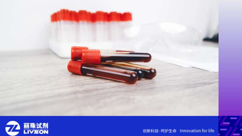 阿尔茨海默症抽血就能查！AD血液标志物检测关键指标解读